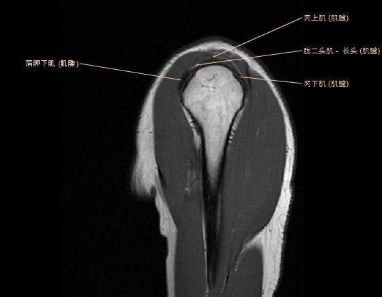 肩关节MRI解剖图谱
