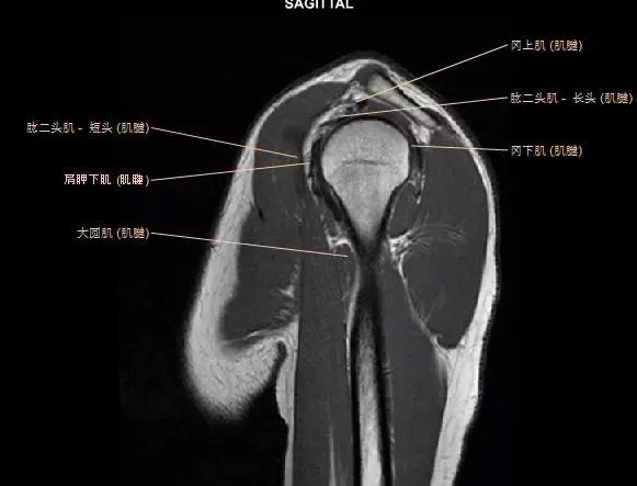 肩关节MRI解剖图谱