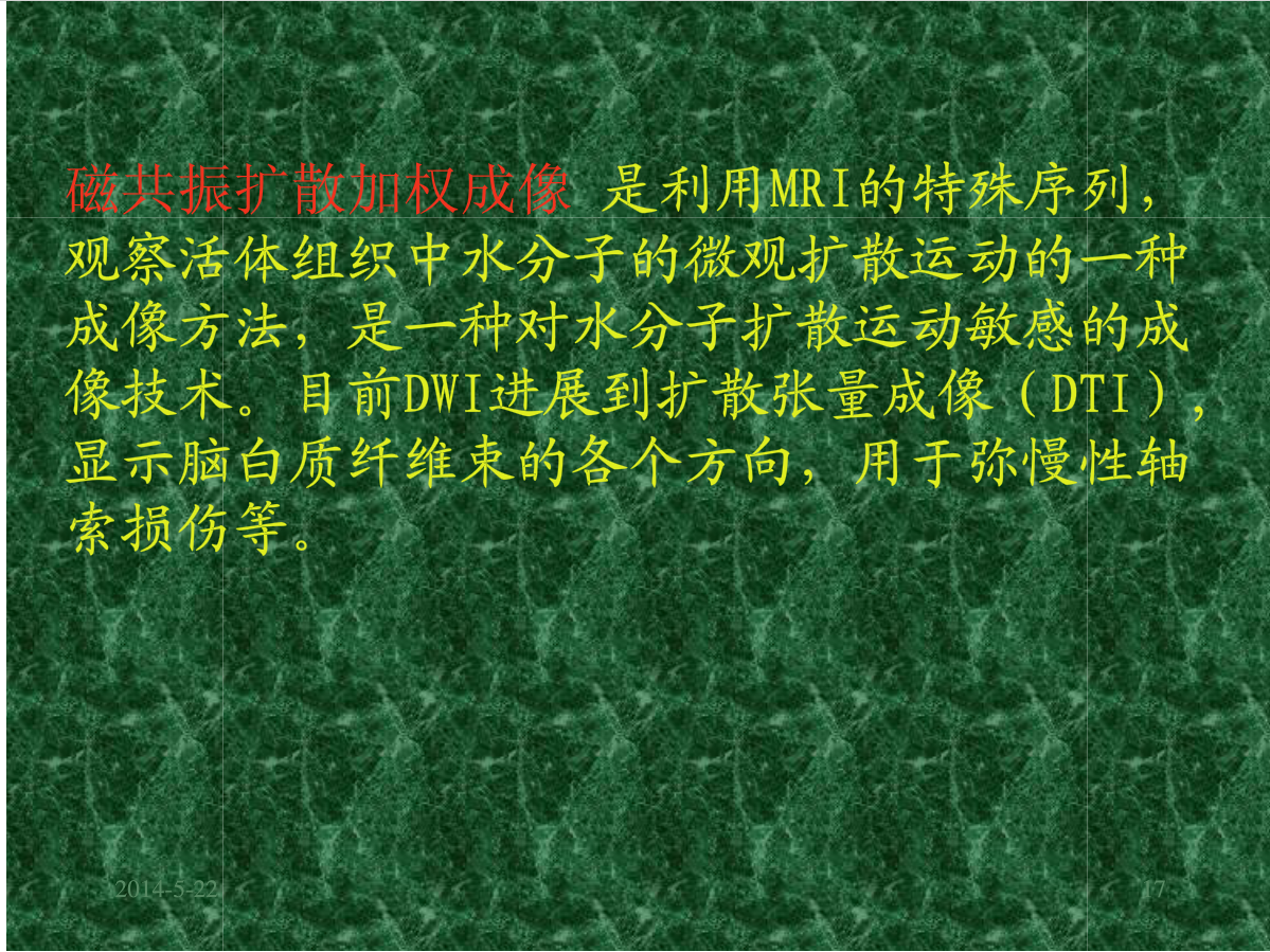MRI成像在中枢神经系统的应用