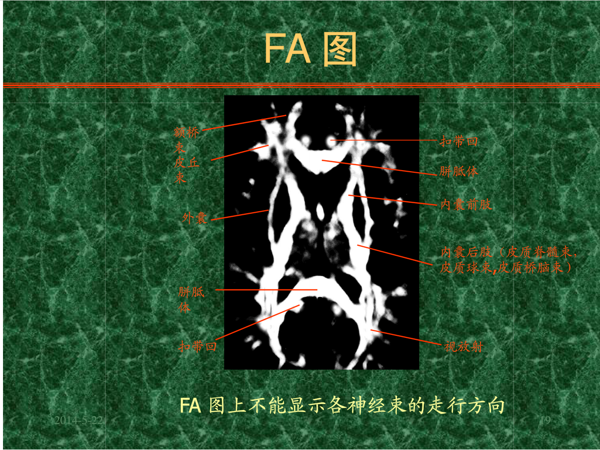 MRI成像在中枢神经系统的应用