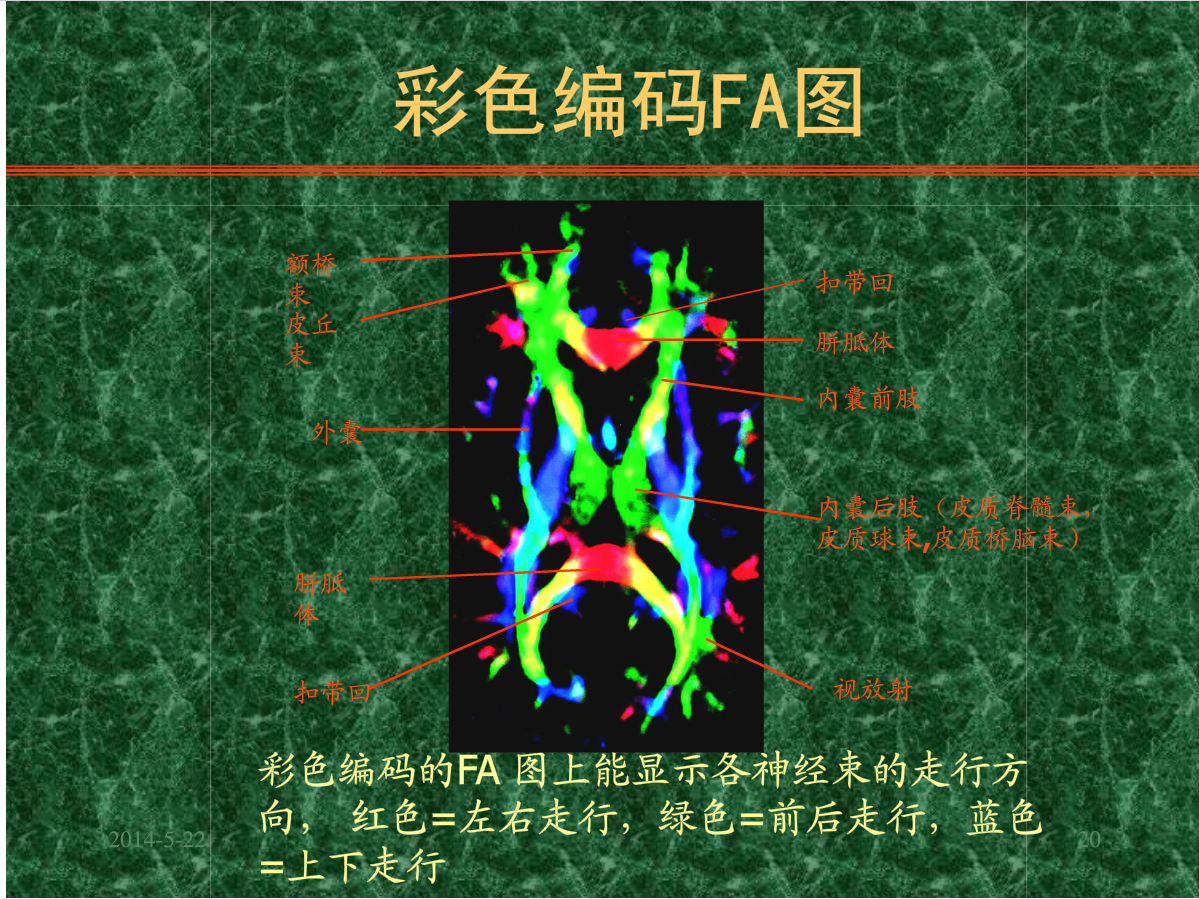 MRI成像在中枢神经系统的应用