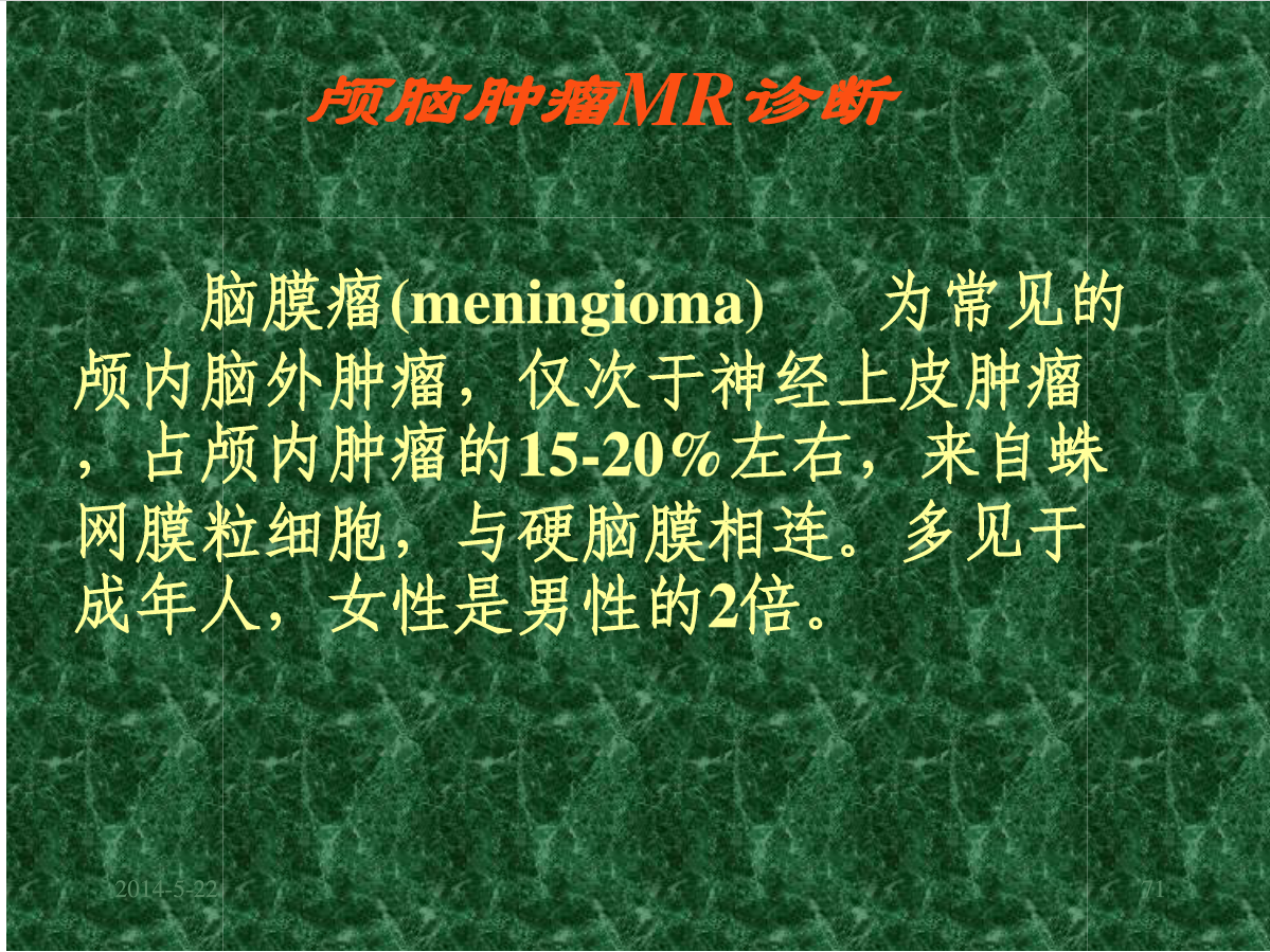 MRI成像在中枢神经系统的应用