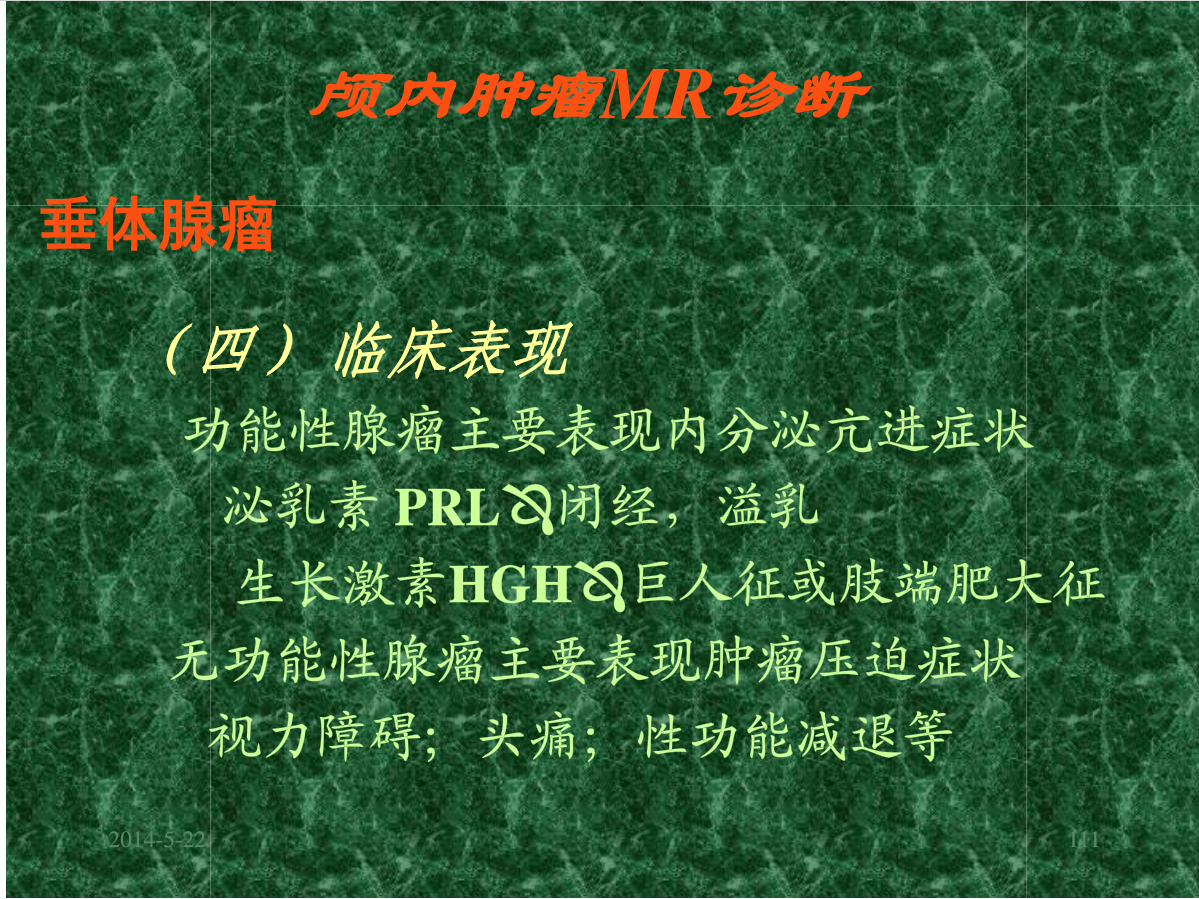 MRI成像在中枢神经系统的应用
