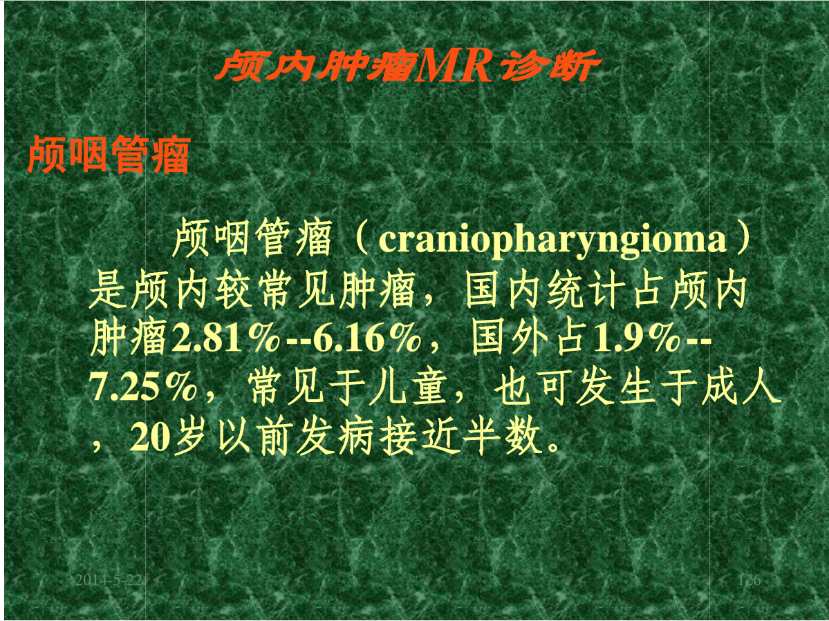 MRI成像在中枢神经系统的应用