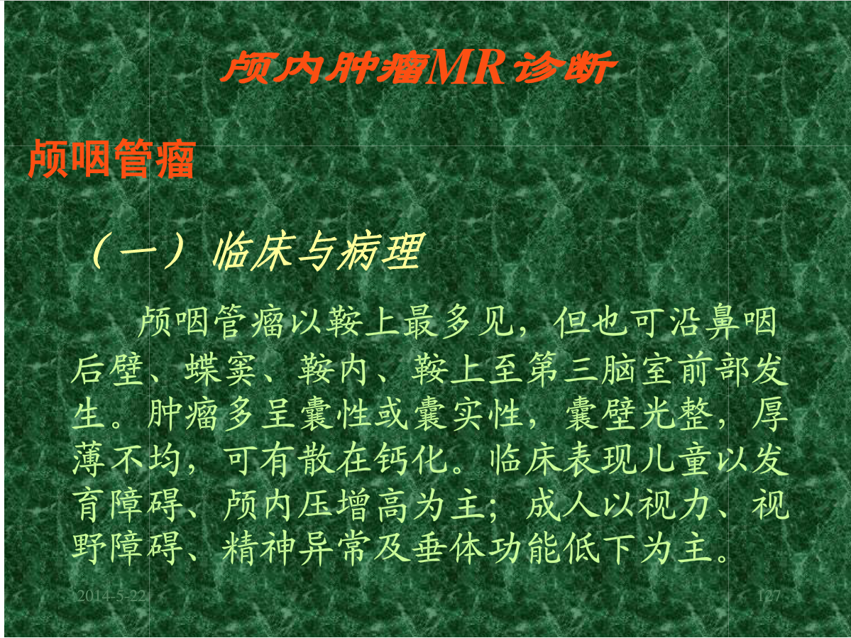 MRI成像在中枢神经系统的应用