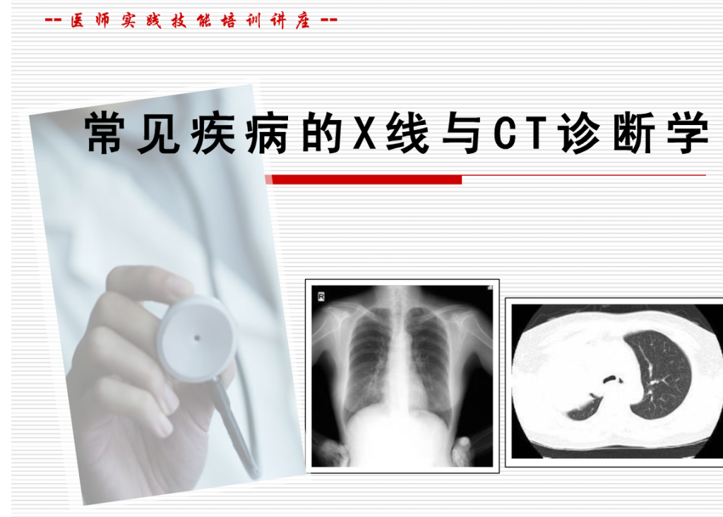常见疾病的X线与CT诊断学
