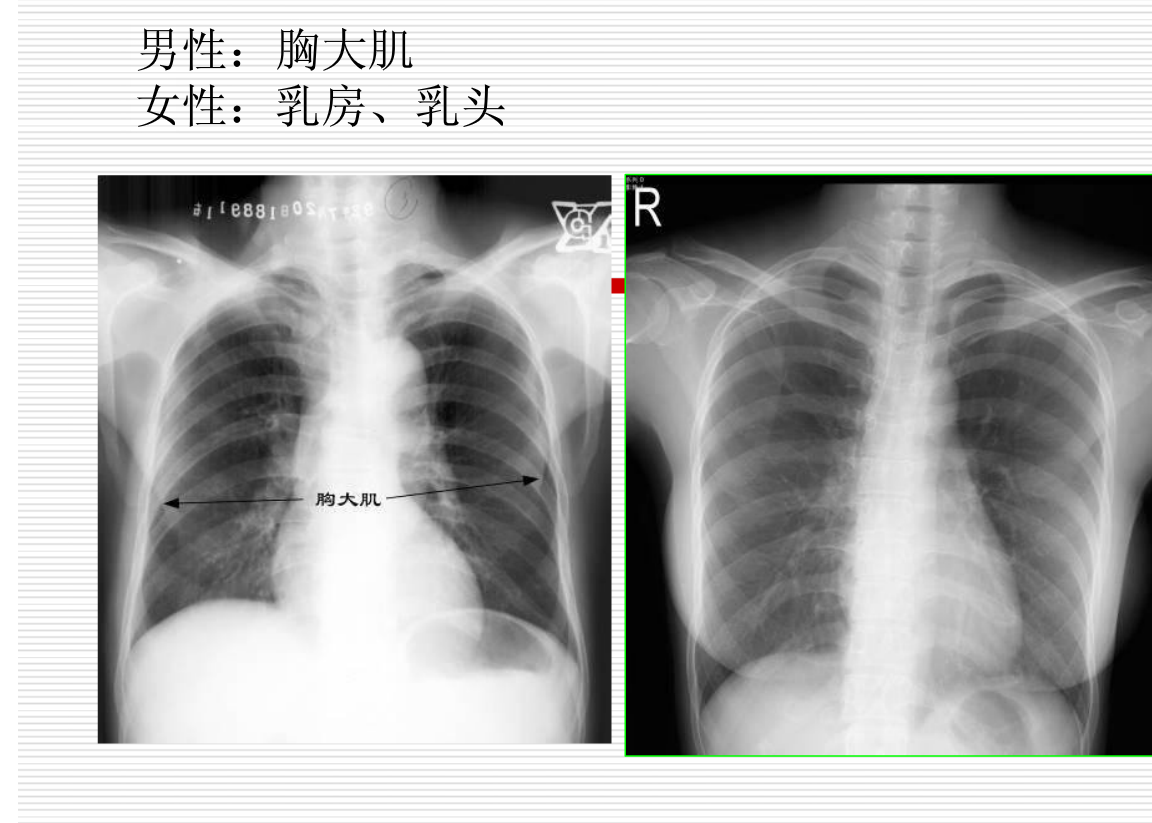 常见疾病的X线与CT诊断学