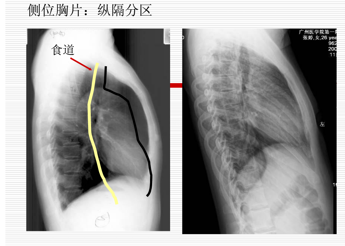 常见疾病的X线与CT诊断学