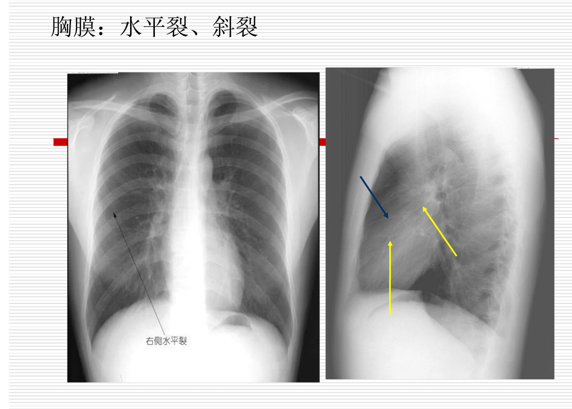 常见疾病的X线与CT诊断学