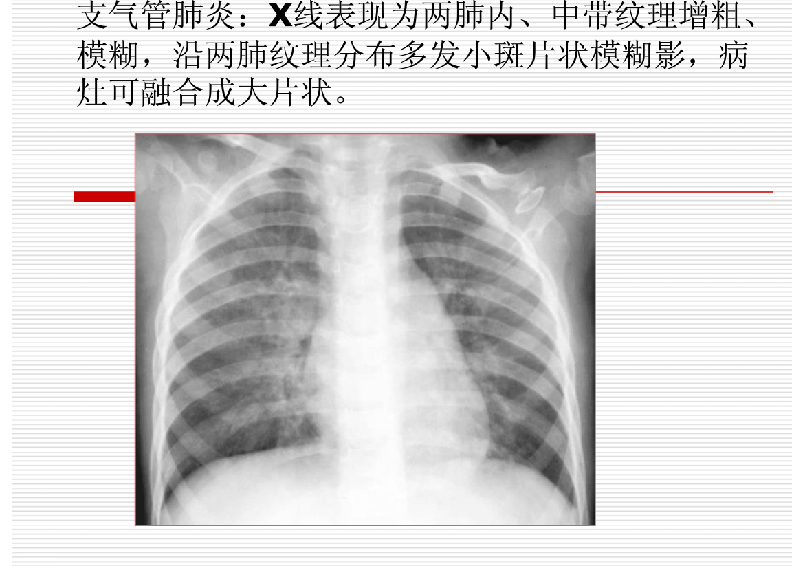 常见疾病的X线与CT诊断学