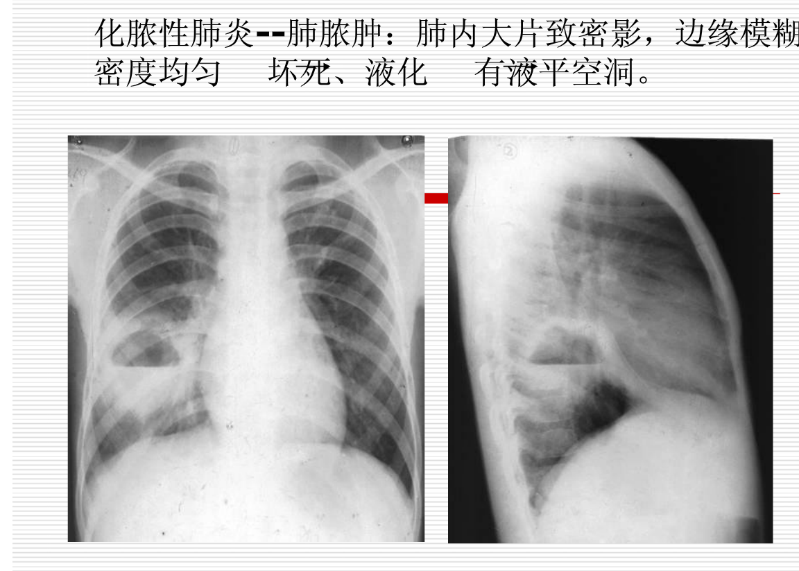 常见疾病的X线与CT诊断学