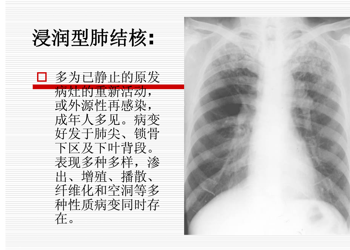 常见疾病的X线与CT诊断学