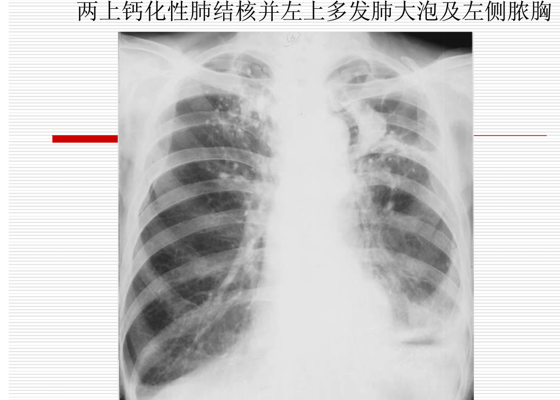 常见疾病的X线与CT诊断学