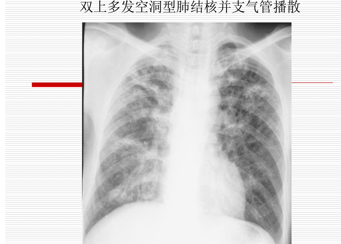 常见疾病的X线与CT诊断学