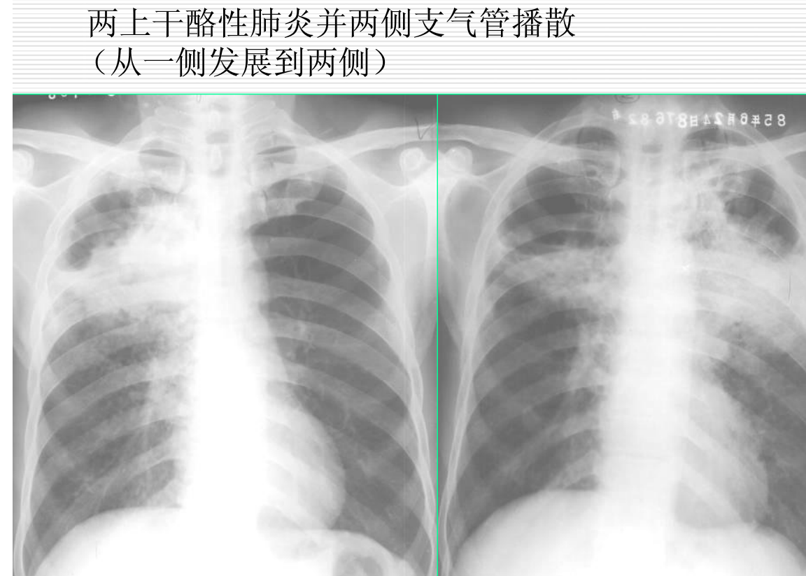 常见疾病的X线与CT诊断学