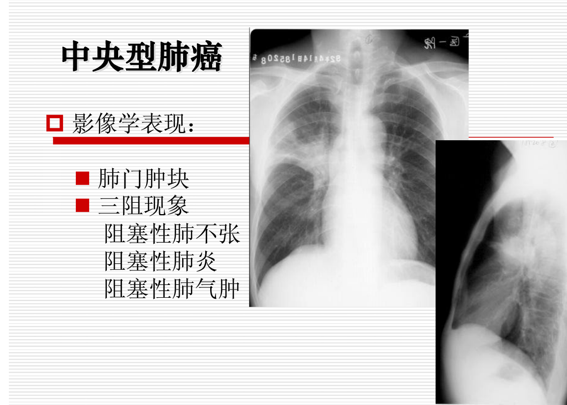 常见疾病的X线与CT诊断学