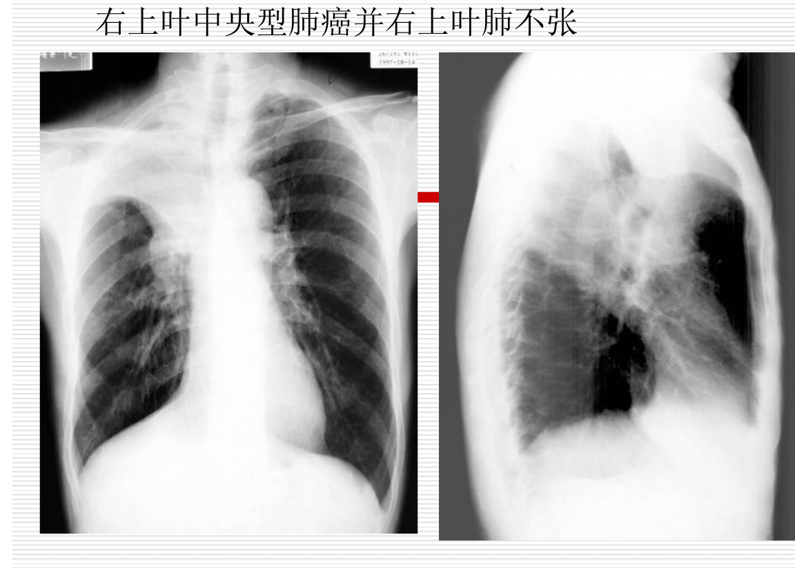 常见疾病的X线与CT诊断学