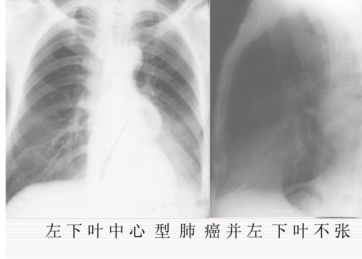 常见疾病的X线与CT诊断学