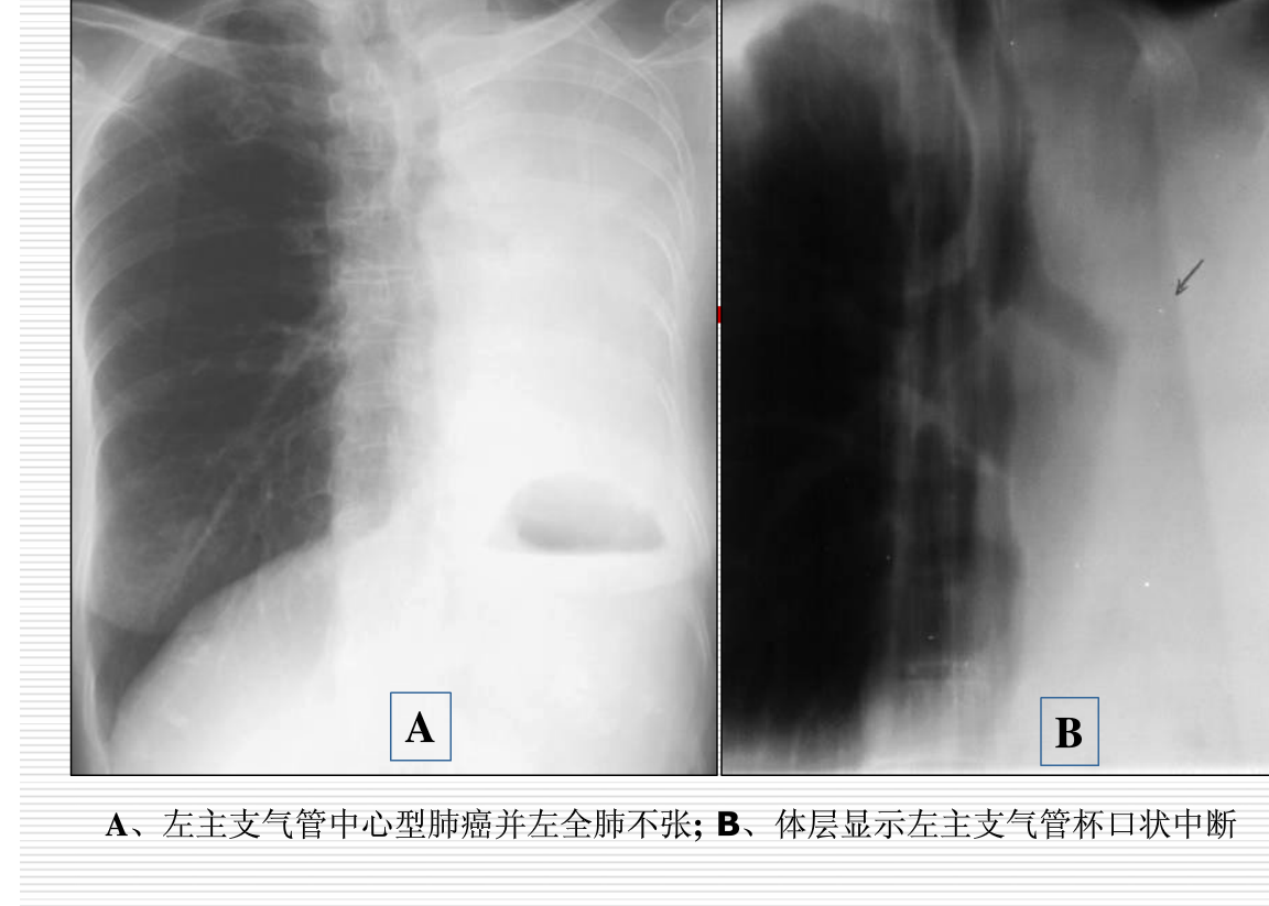 常见疾病的X线与CT诊断学