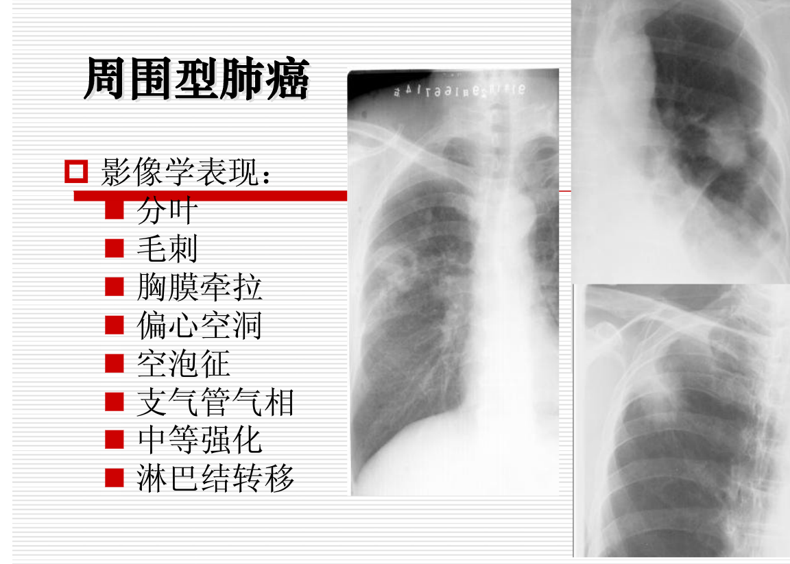 常见疾病的X线与CT诊断学