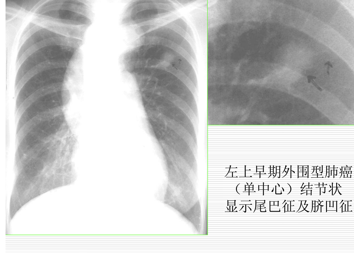 常见疾病的X线与CT诊断学
