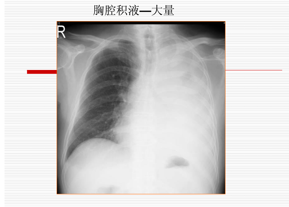 常见疾病的X线与CT诊断学