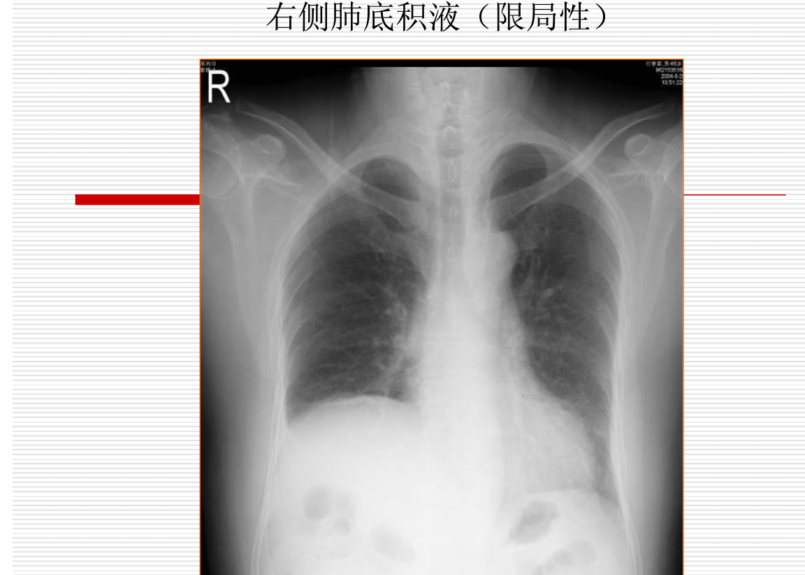 常见疾病的X线与CT诊断学