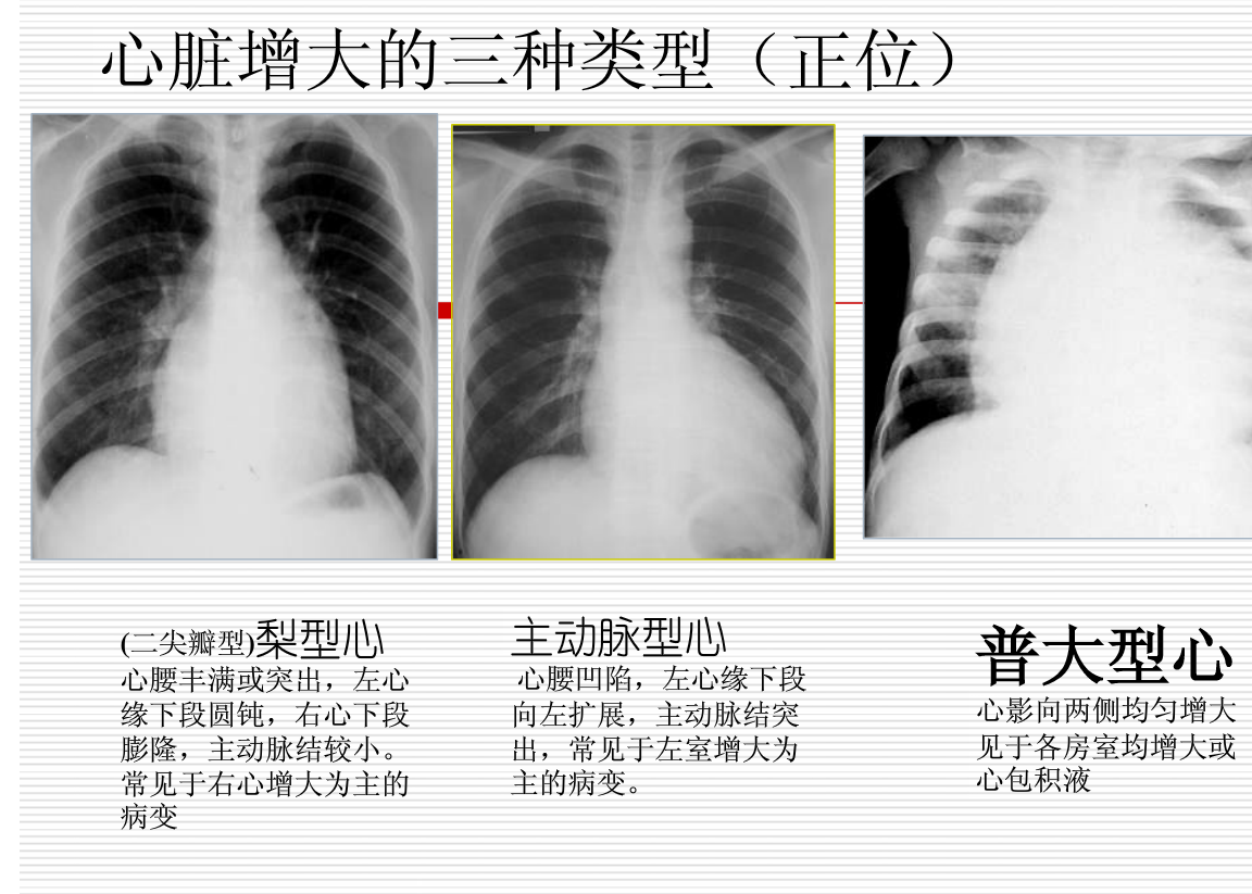 常见疾病的X线与CT诊断学