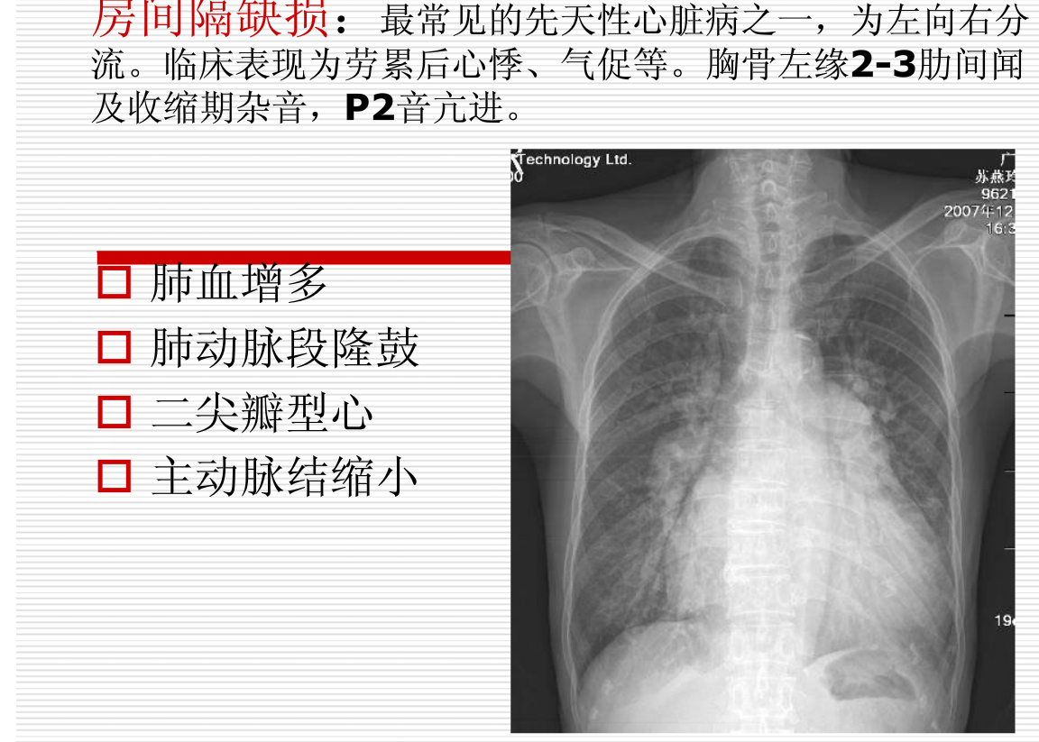 常见疾病的X线与CT诊断学