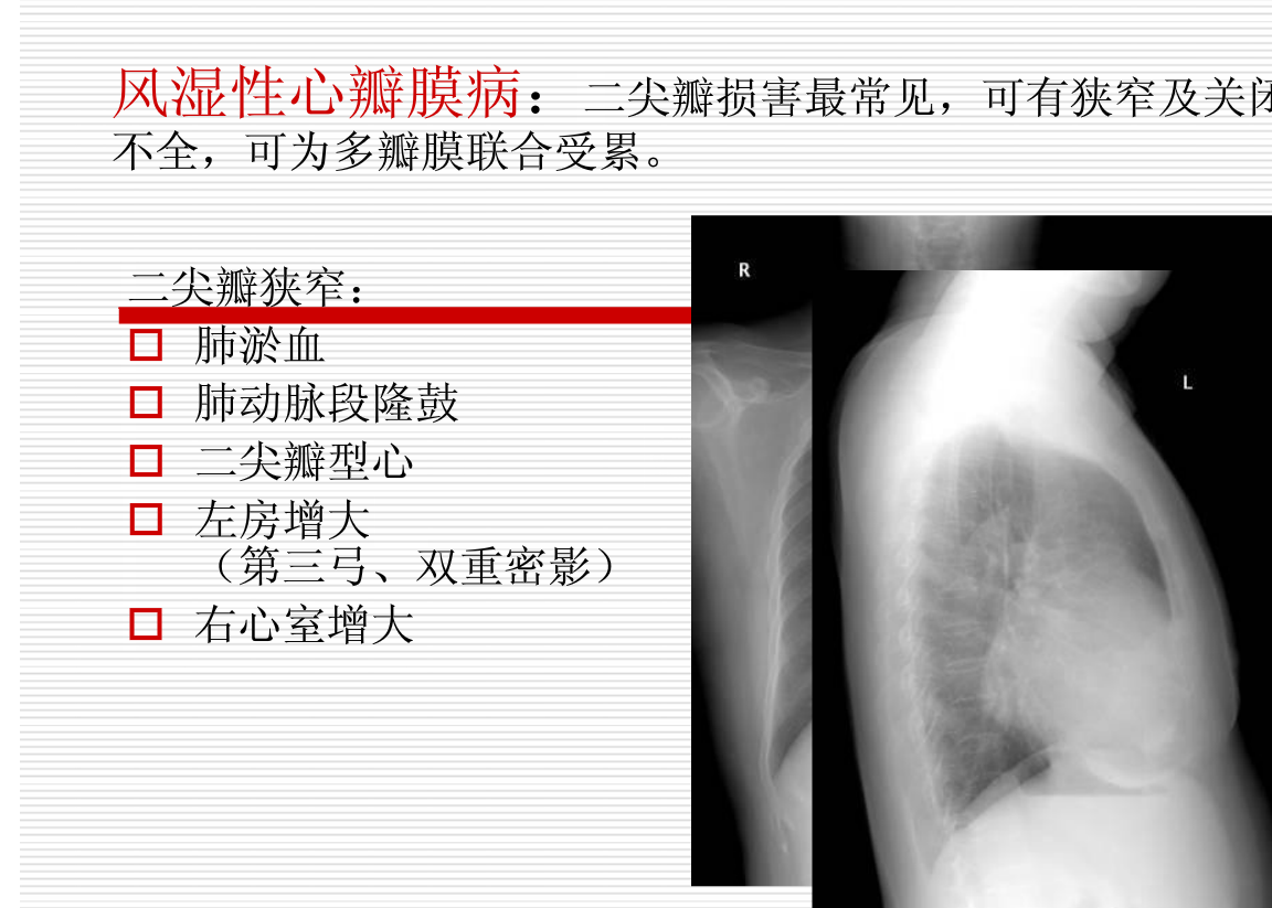 常见疾病的X线与CT诊断学