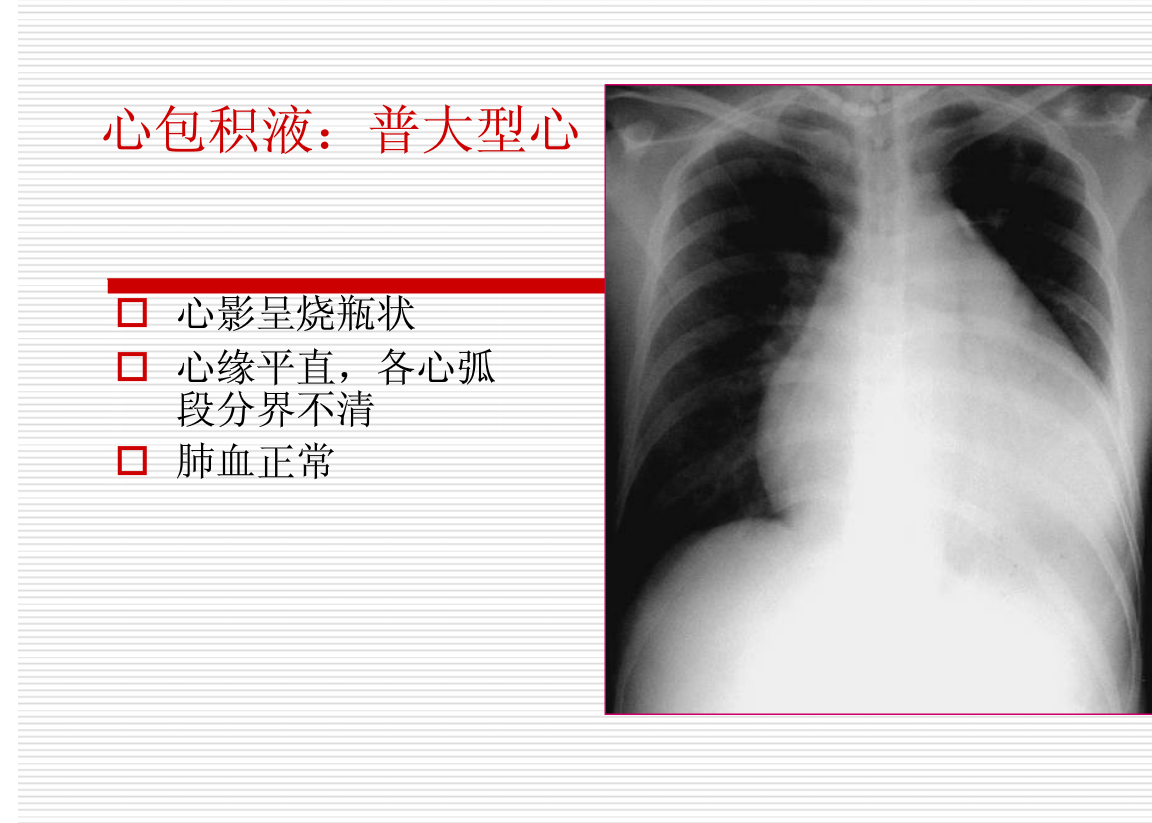 常见疾病的X线与CT诊断学