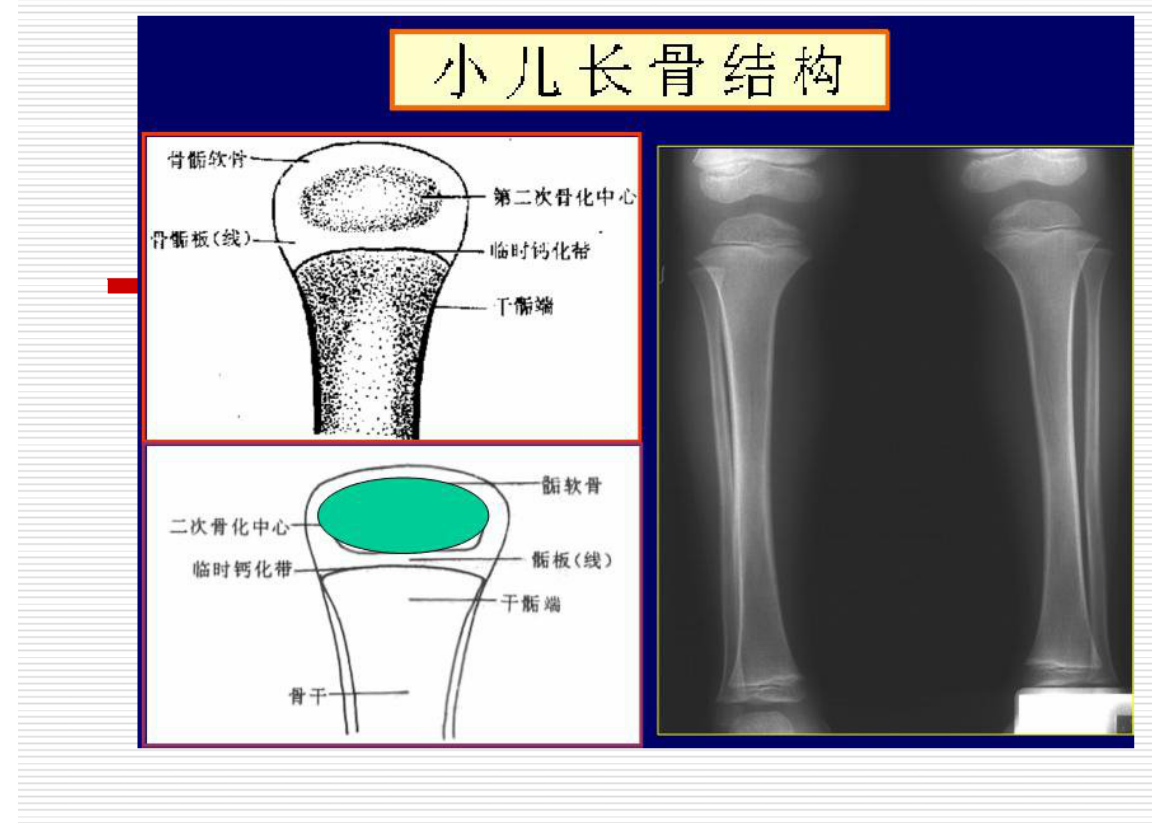 常见疾病的X线与CT诊断学