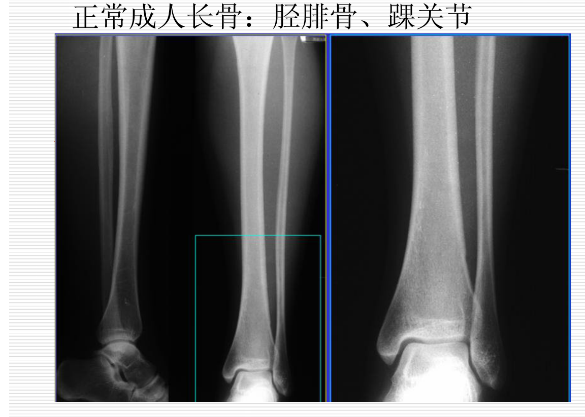 常见疾病的X线与CT诊断学
