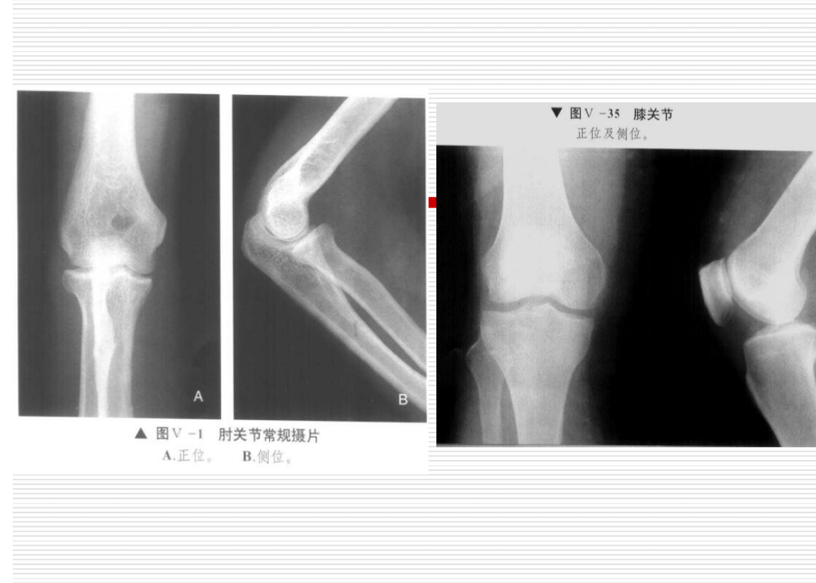 常见疾病的X线与CT诊断学