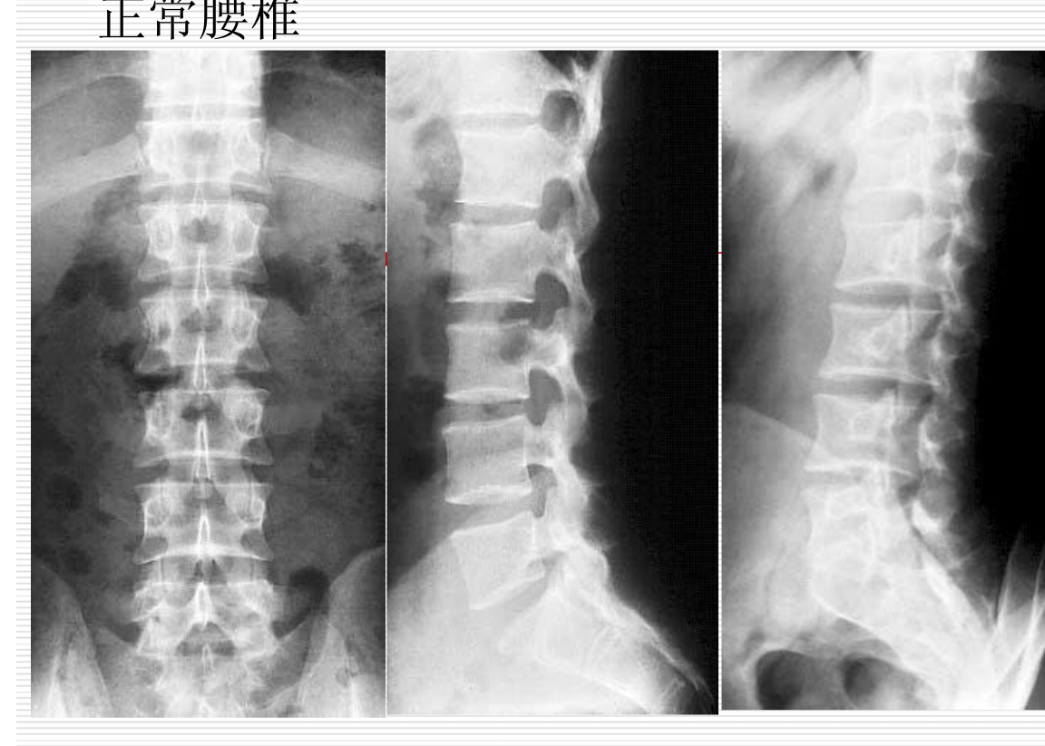 常见疾病的X线与CT诊断学