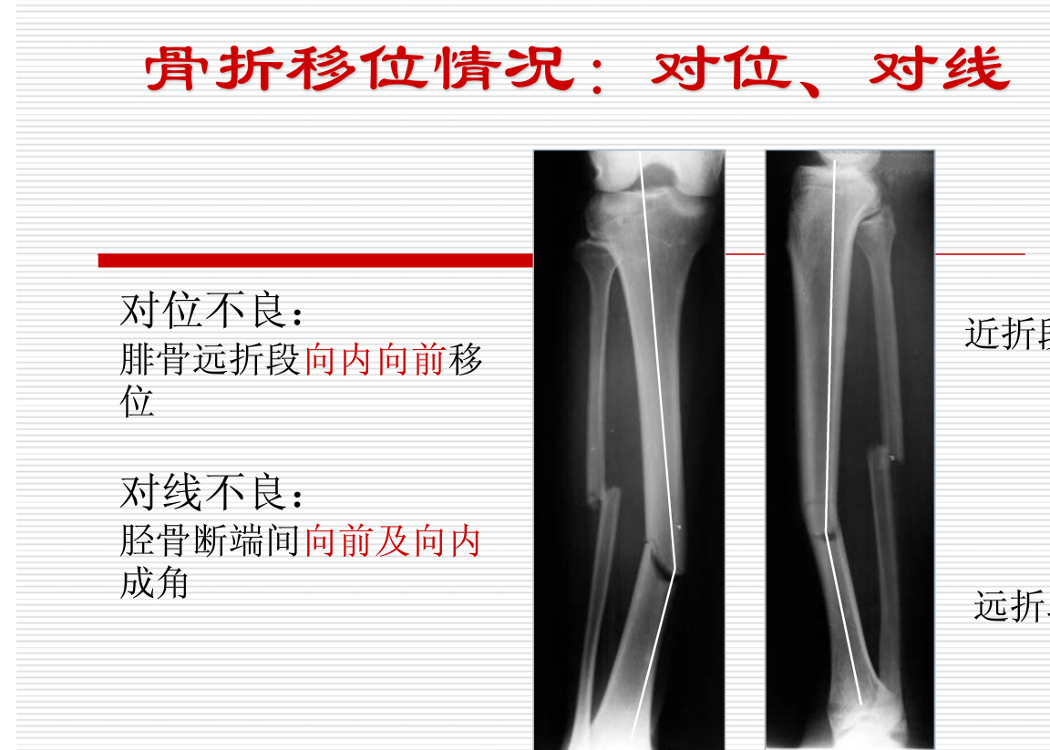 常见疾病的X线与CT诊断学