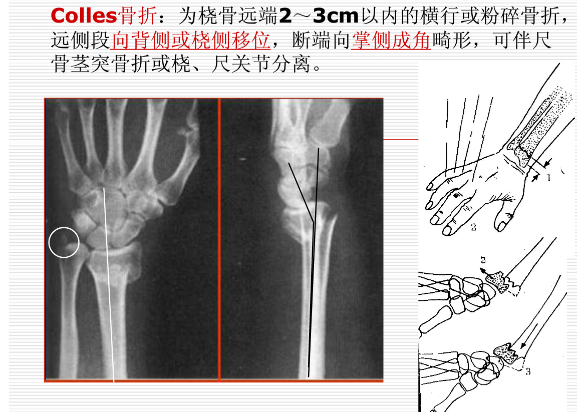 常见疾病的X线与CT诊断学