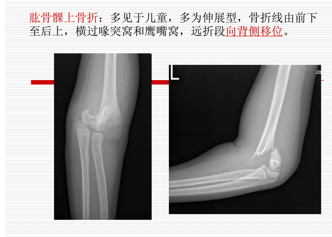 常见疾病的X线与CT诊断学