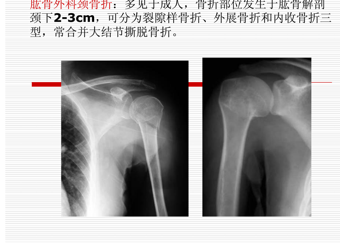 常见疾病的X线与CT诊断学