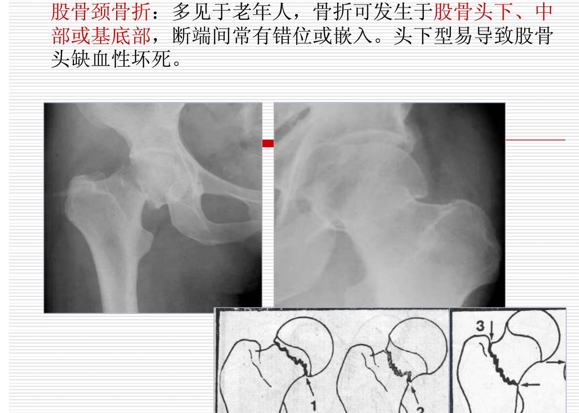 常见疾病的X线与CT诊断学