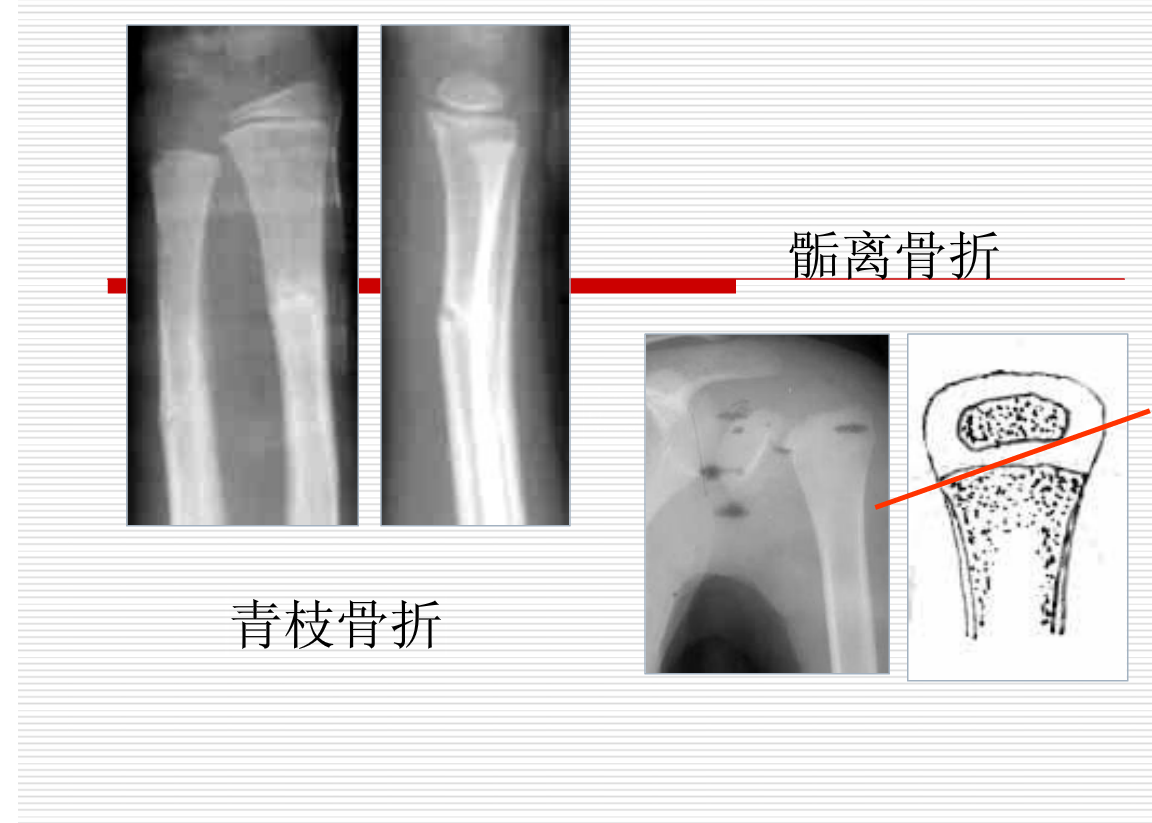常见疾病的X线与CT诊断学