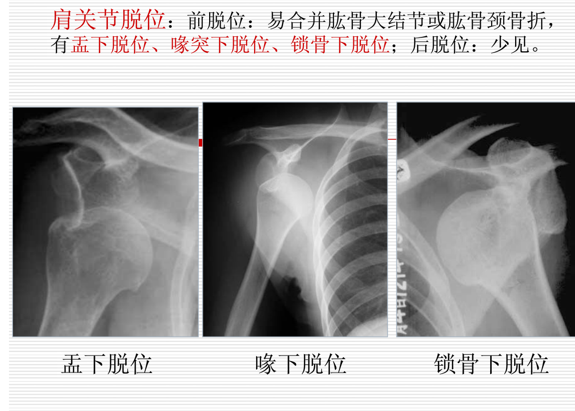 常见疾病的X线与CT诊断学