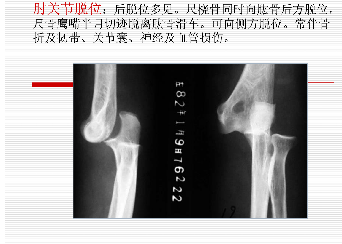常见疾病的X线与CT诊断学