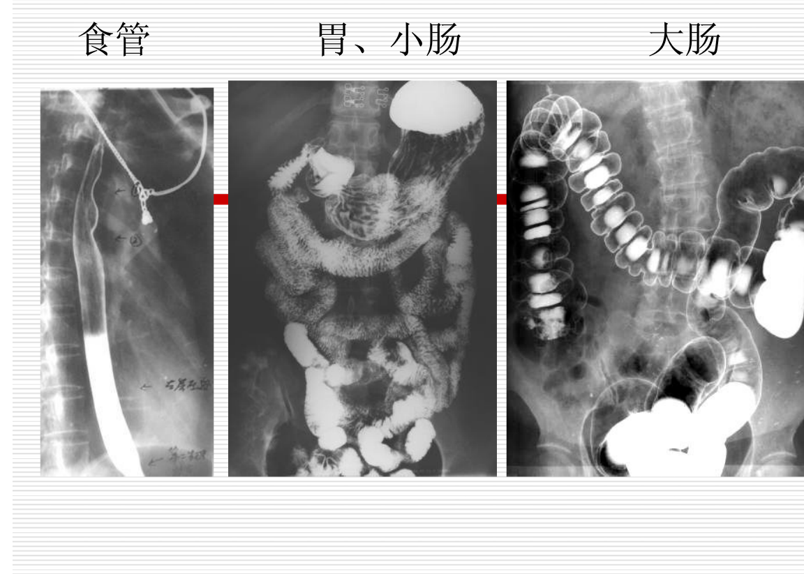 常见疾病的X线与CT诊断学