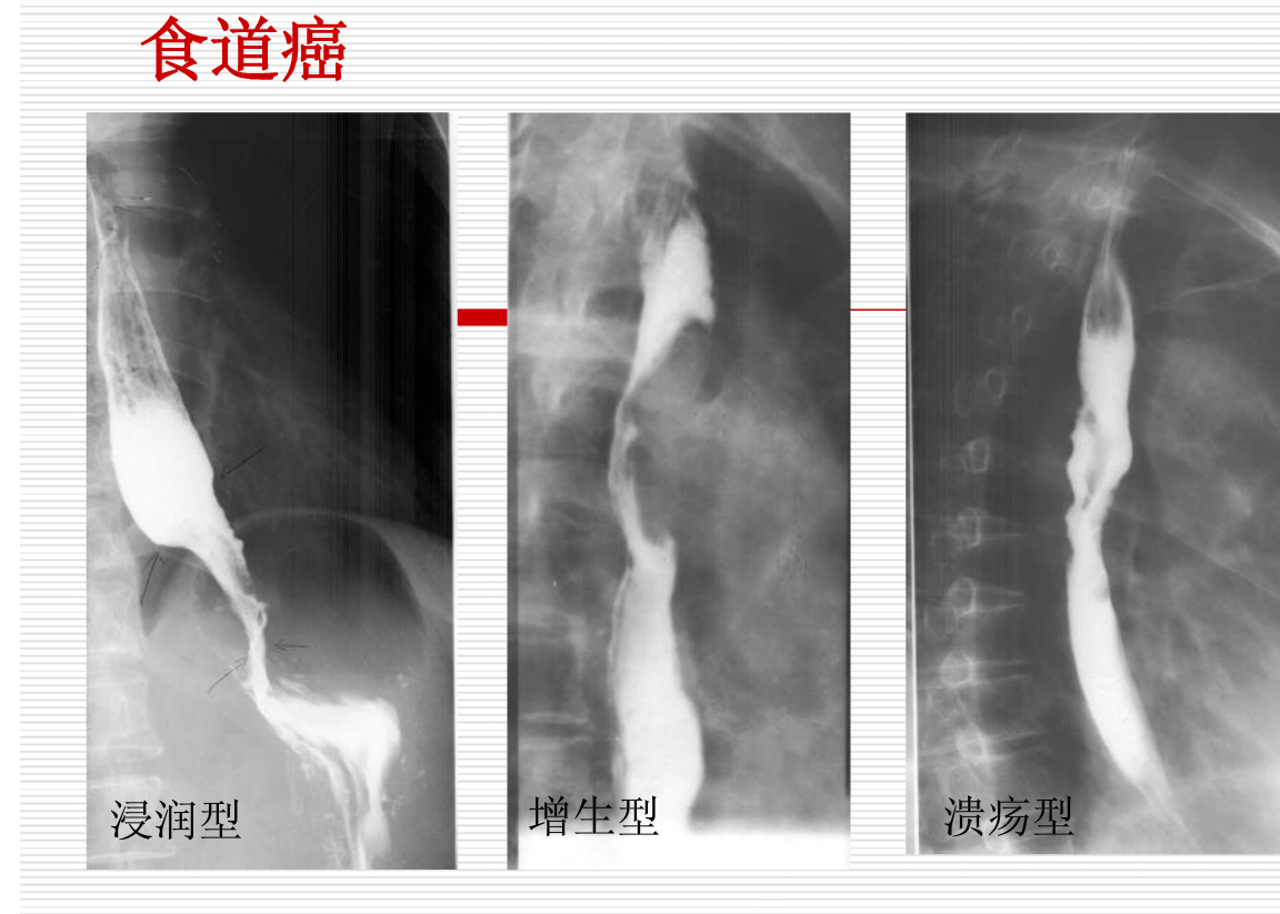 常见疾病的X线与CT诊断学