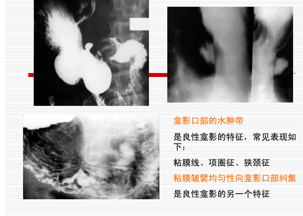 常见疾病的X线与CT诊断学
