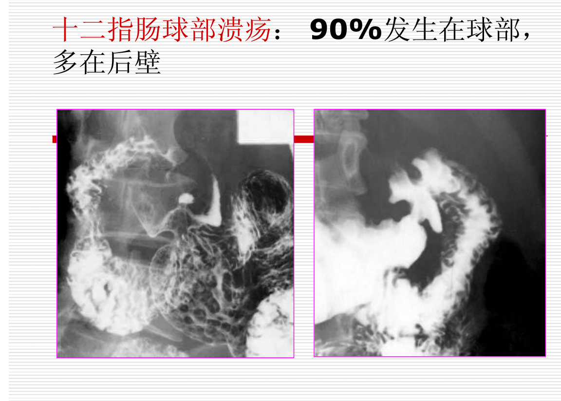 常见疾病的X线与CT诊断学