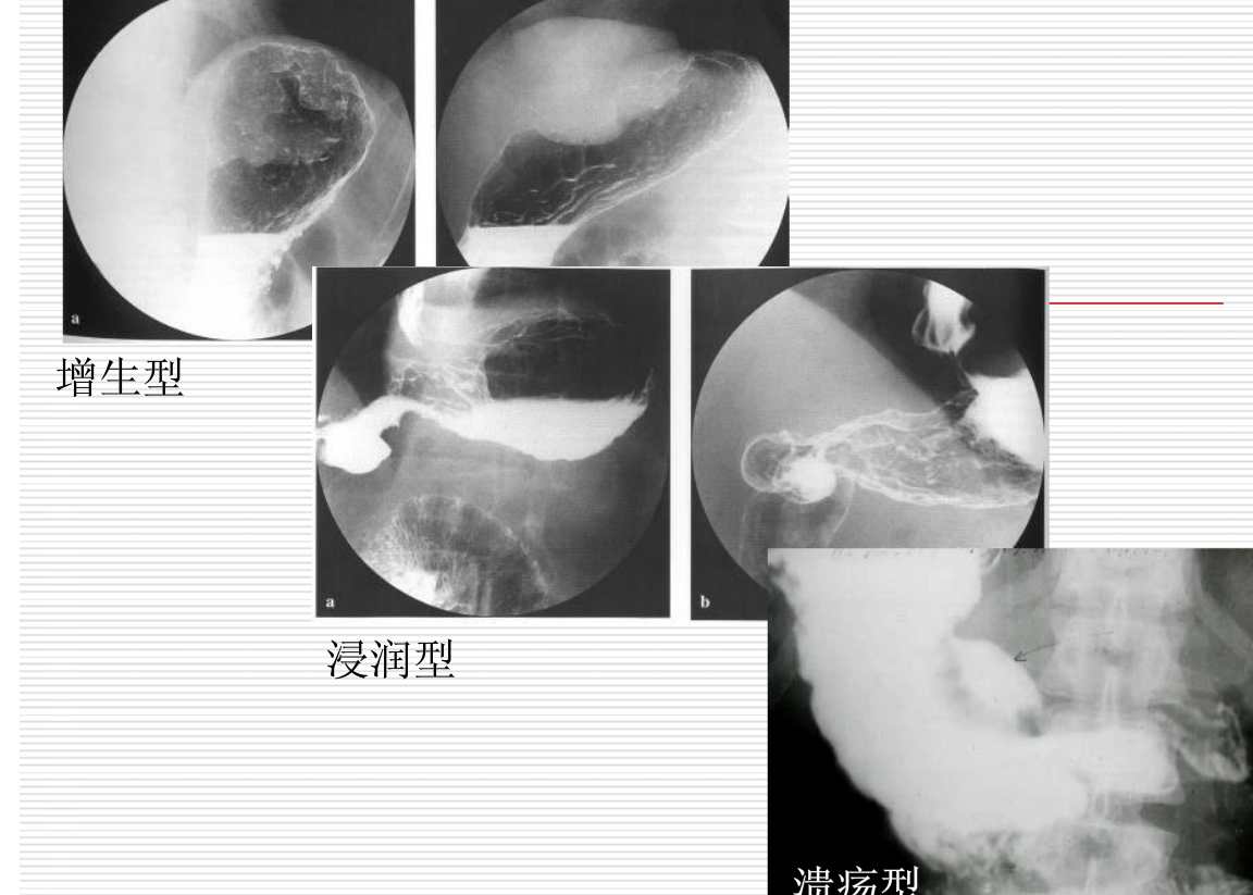 常见疾病的X线与CT诊断学