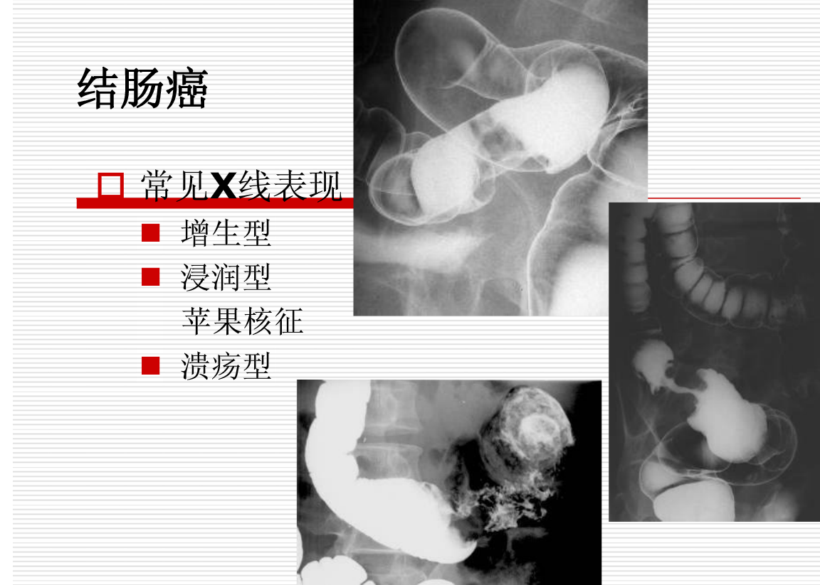 常见疾病的X线与CT诊断学