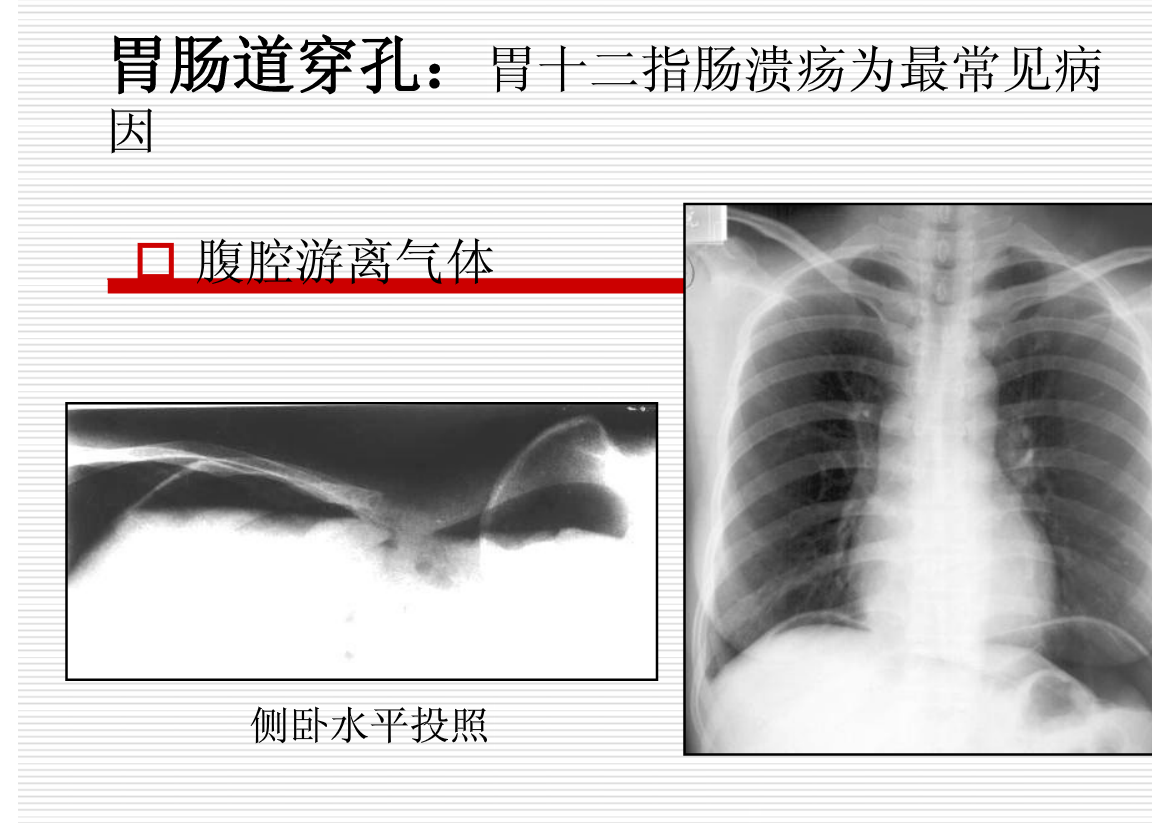 常见疾病的X线与CT诊断学